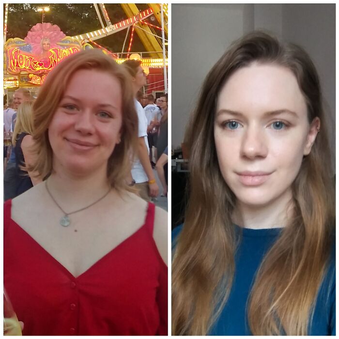 19 To 23. Therapy And Excersice Certainly Made A Change Mentally And Physically. Still Struggling With Confidence And Selflove But All Good Things Take Time. Slow And Steady