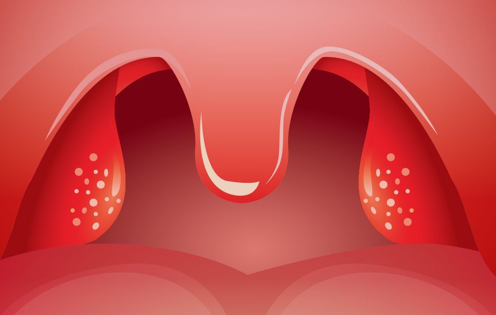 Your tonsils can grow back if there is some tissue left behind during the removal process.