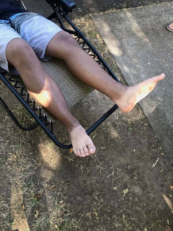 uneven tan on legs