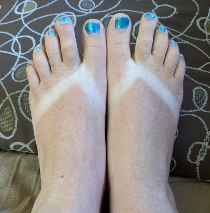 20 Times Tanning Didn't Go As Planned.