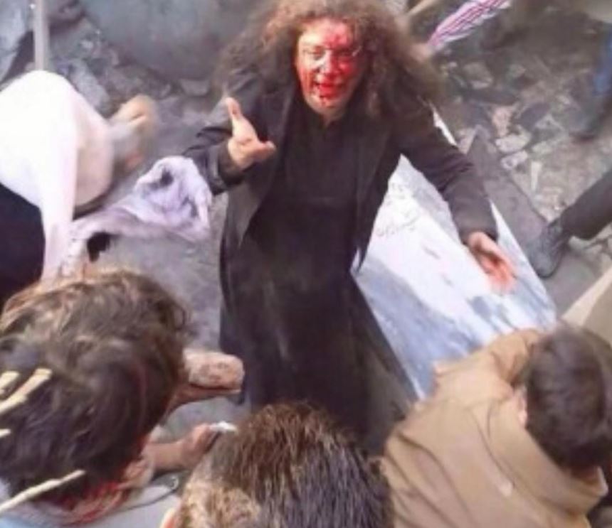 Farkhunda Malikzada (in 2015) was ran over by a car, pushed of a roof, publicly beaten, stoned, and then burnt to death simply for ‘burning the quran’. After she died, they realized that she had in fact NOT burnt the Quran