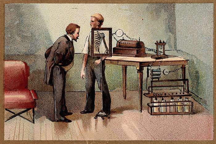 that in the 1890s, X-Rays were used extensively as entertainment. People could even buy or build their own X-ray apparatus for use at home. Many who popularized the technology developed cancer, suffered amputations, or died.