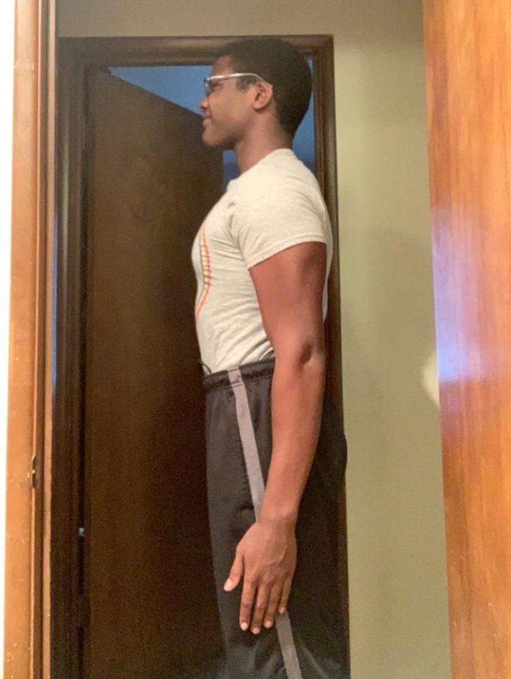“I (17M) have abnormally long arms 5’9 with a 6’6 wingspan.”
