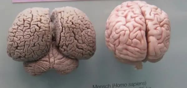A dolphin brain versus the size of a human’s.
