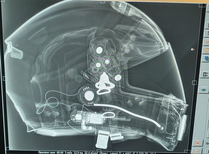 “Managed to X-ray my helmet the other day.”