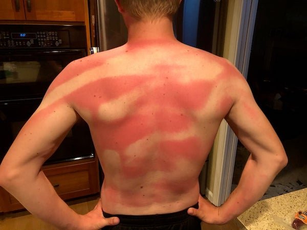 My Wife helped me sunscreen my back at beach day today (TWICE)!!