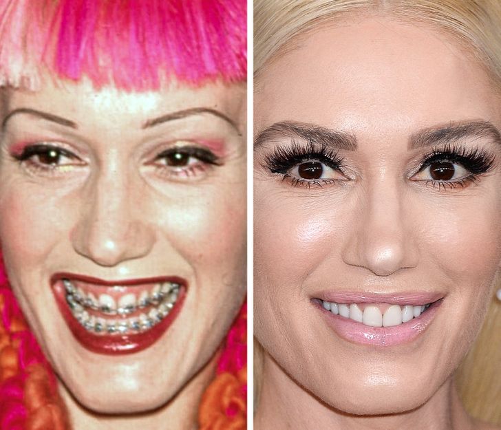 Gwen Stefani, 29 years old and 50 years old