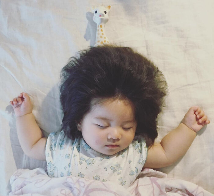 baby born with lots of hair