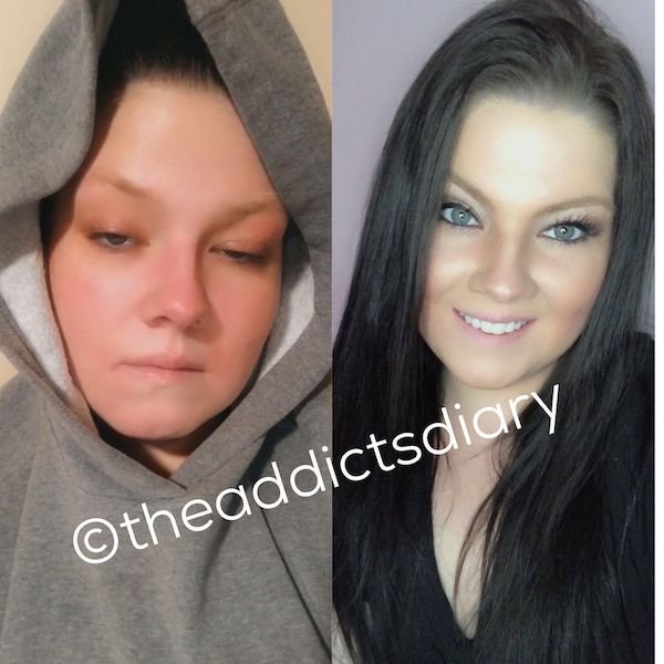 My name is Grace and I am an addict. I went from being the daughter of two police officers who was completely against drugs to the girl who needed to get high just to make it through the day. I became unrecognizable so quickly. I never would have thought I would be the girl addicted to drugs but I was. After losing the love of my life to this awful disease in May of 2020 I relapsed after having some clean time.

My bottom kept getting lower and lower. How could I turn to the same drug that killed the person I love? I’ll never understand that but addiction is so powerful. I’m proud to say that I now have 6 months of constant sobriety under my belt and I’ve never felt better. From waking up every morning wishing I hadn’t to actually looking forward to my future. I’m so grateful for a second chance at life. Recovery is possible.