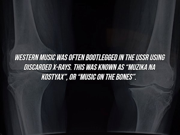 x ray - Western Music Was Often Bootlegged In The Ussr Using Discarded XRays. This Was Known As Muzika Na Kostyax, Or Music On The Bones".