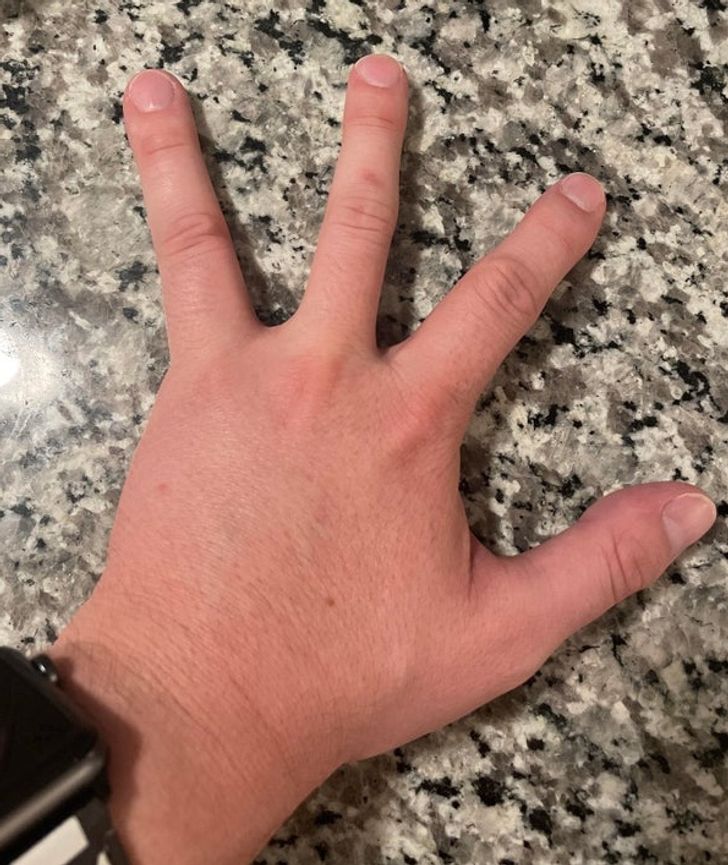 cool stuff people found - man with only 4 fingers reddit