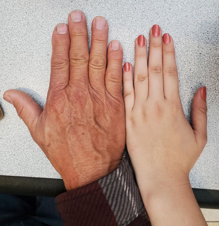 “I inherited this small gap between my middle and ring finger from my dad. Both hands are like this.”