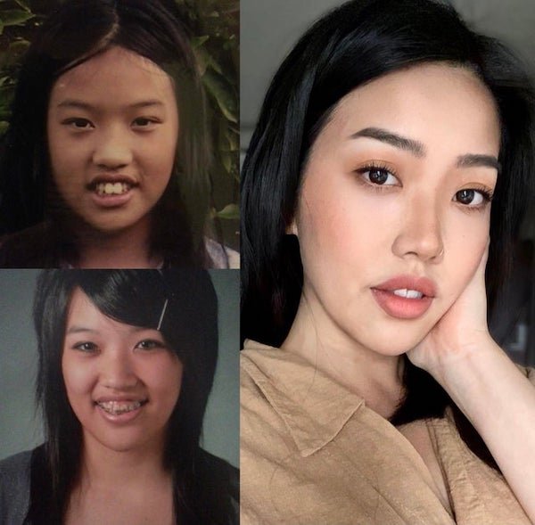 25 Ugly Ducklings Who Grew Up.