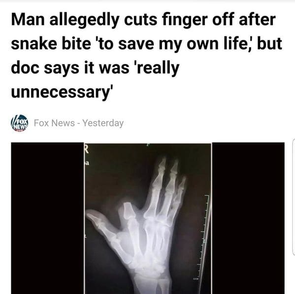 people having an even worse day then you - Man allegedly cuts finger off after snake bite 'to save my own life, but doc says it was 'really unnecessary Fox Fox News Yesterday