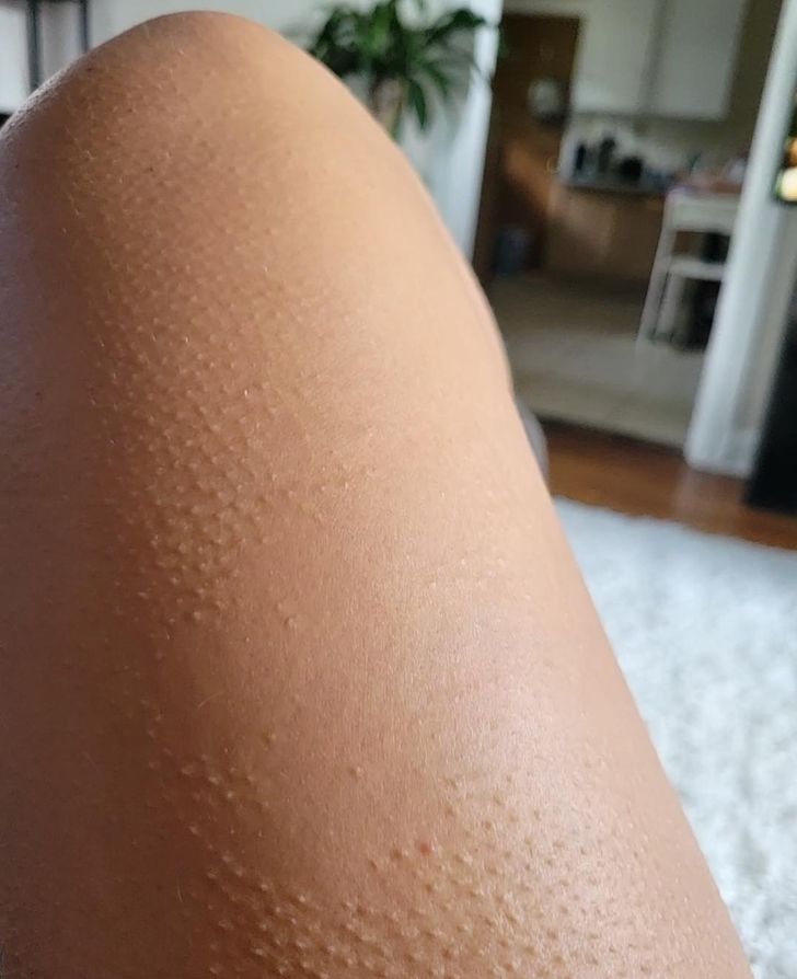 “There’s a patch on my leg that doesn’t get goosebumps.”