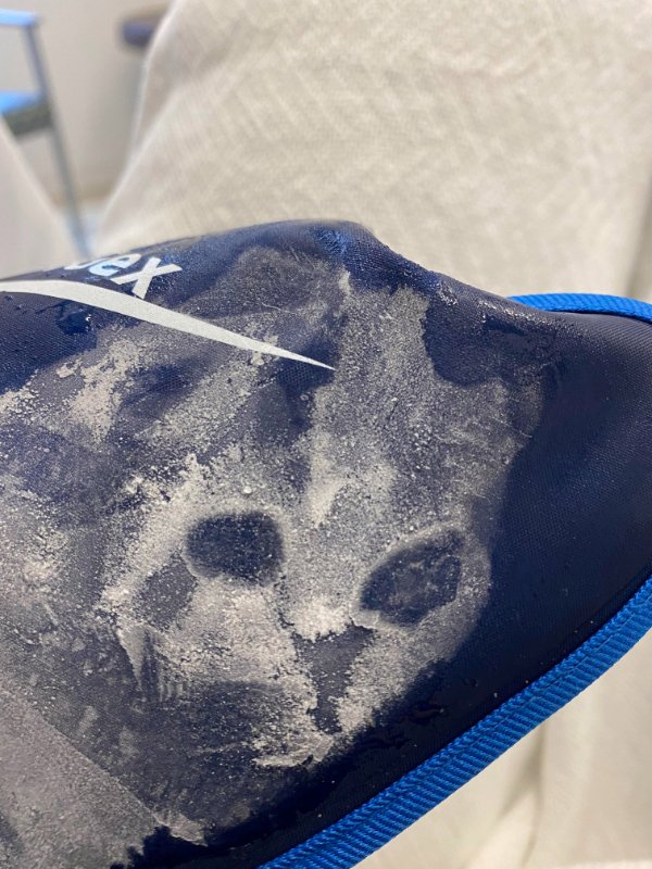 “The frost on my ice glove looks like a cat.”