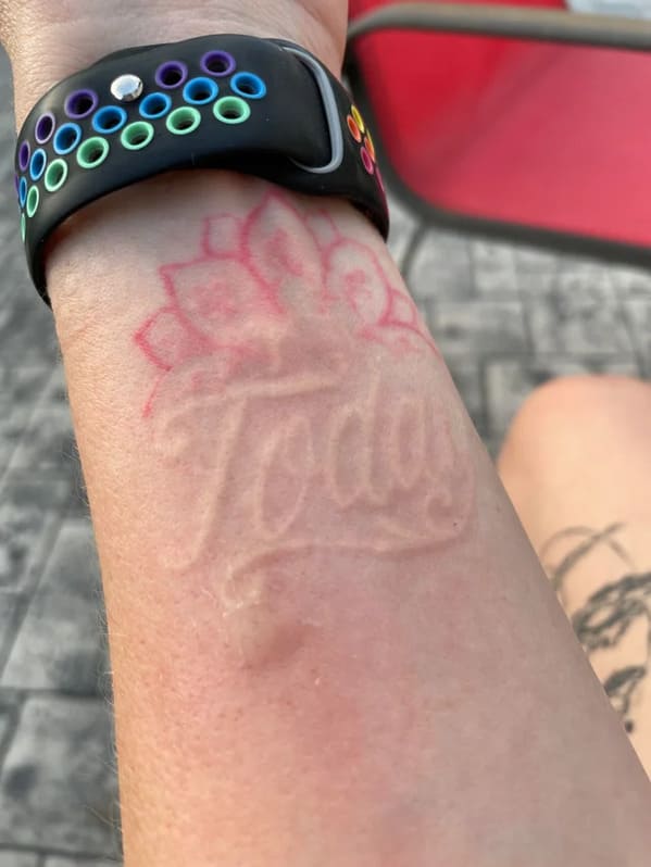 awesome stuff people saw - mosquito bite tattoo - Oo