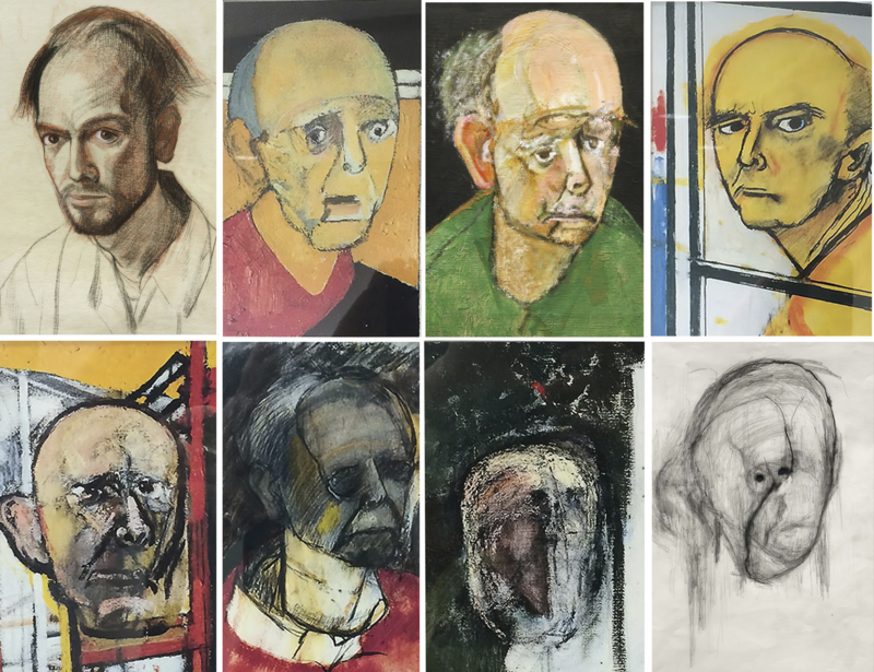 After being diagnosed with Alzheimer’s disease, artist William Utermohlen decided to create a self portrait each year until he was no longer able to draw.
