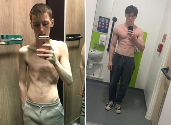 wholesome - feels - anorexia transformation