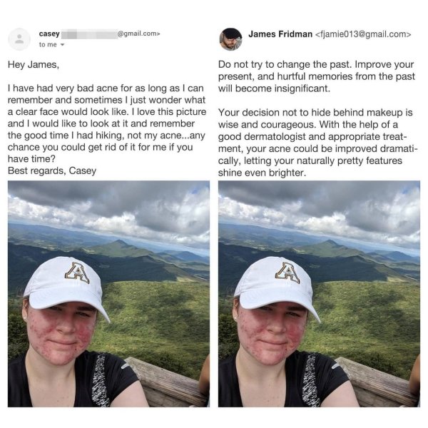 cap - casey to me .com> James Fridman  Hey James, Do not try to change the past. Improve your present, and hurtful memories from the past I have had very bad acne for as long as I can will become insignificant. remember and sometimes I just wonder…