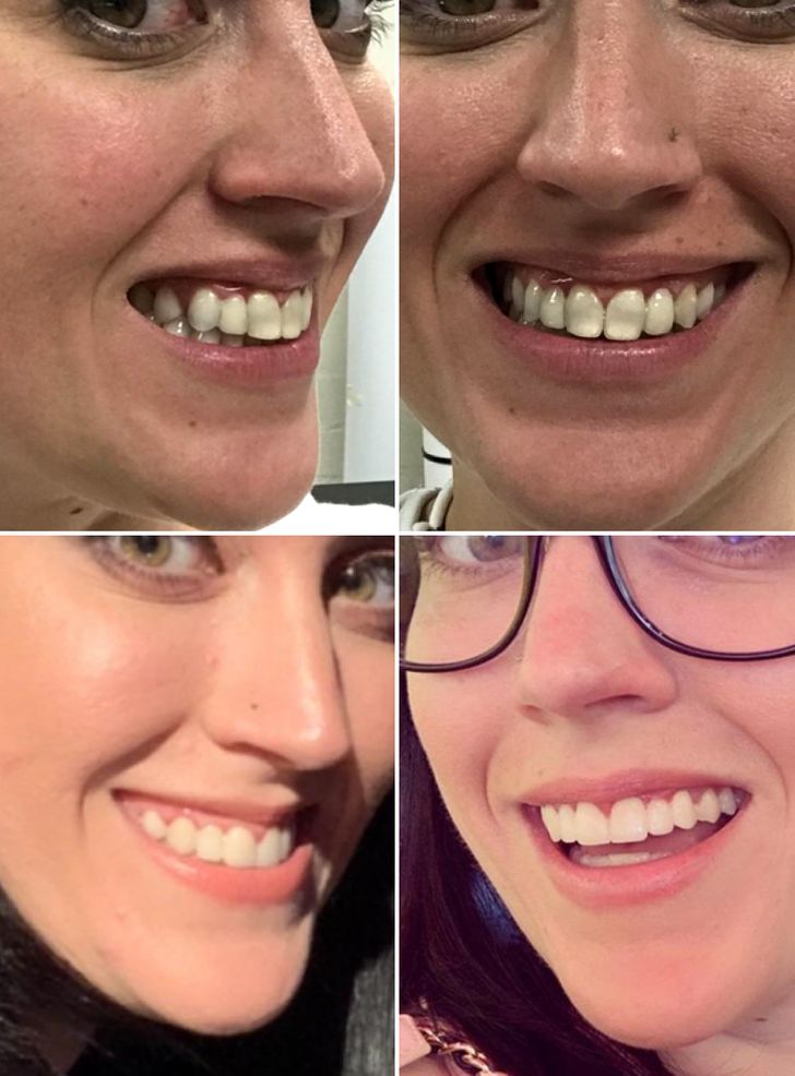 “I used to have missing and broken teeth. It took 35 years, but I finally feel good about smiling.”