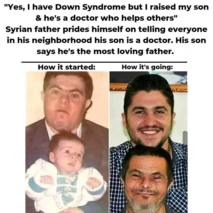 man - "Yes, I have Down Syndrome but I raised my son & he's a doctor who helps others" Syrian father prides himself on telling everyone in his neighborhood his son is a doctor. His son says he's the most loving father. How it started How it's going