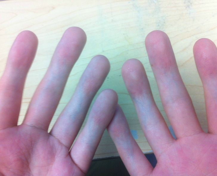 a collection of amazing and fascinating photos - fingers without joints - Waan