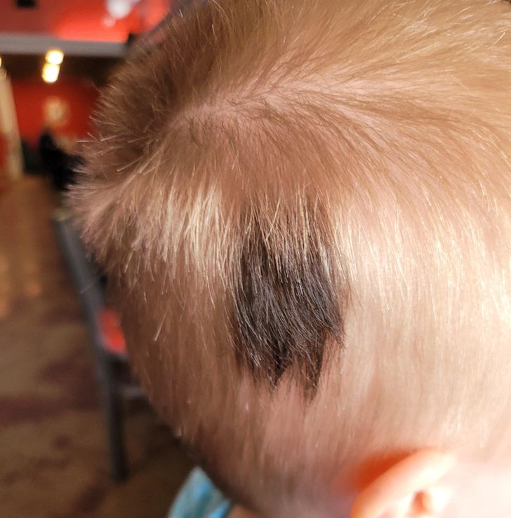 a collection of amazing and fascinating photos - black birthmark in hair