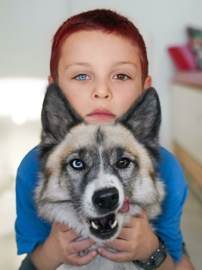 Heterochromia which means having two different colored eyes is found in less than 1% of the population.