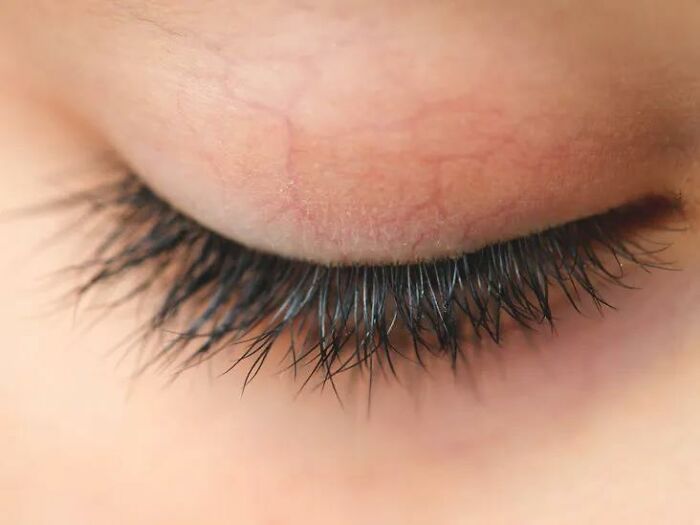 About 1% of the population has a double line of eyelashes.