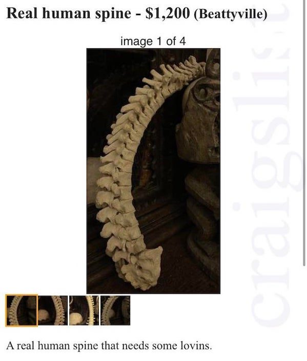 wtf things being sold online - Real human spine $1,200 Beattyville image 1 of 4 craigslist A real human spine that needs some lovins.