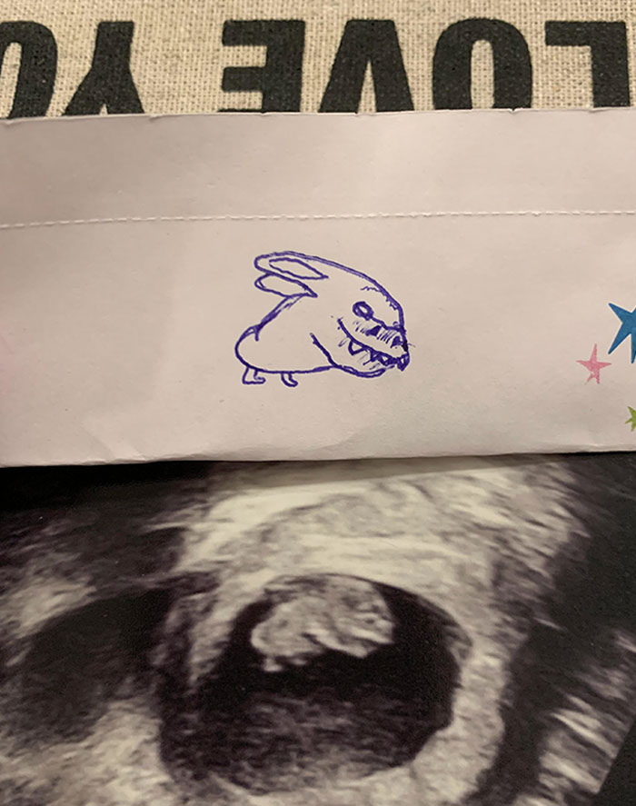 I Found Out I’m Going To Be An Uncle. My Sister Wasn’t Too Happy About My Interpretation Of Her Upside Down Ultrasound