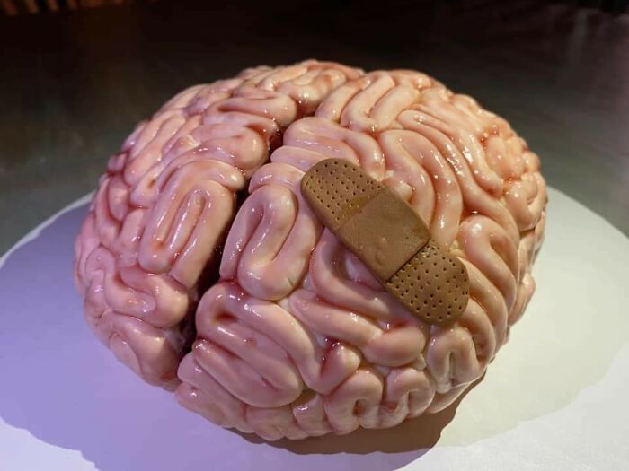 My Sister Made A Happy-One-Year-Since-Brain-Surgery Cake