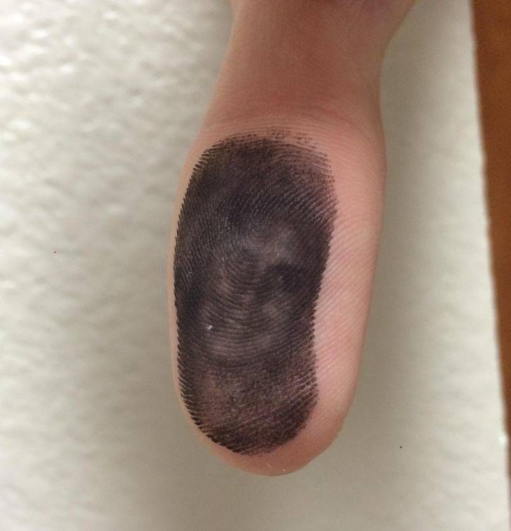 “A co-worker went to grab a jammed piece of paper in the printer. He ended up getting this.”