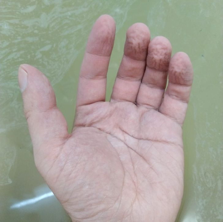 Finger skin wrinkles in the water to help make our lives easier. Wrinkling helps our fingers hold wet objects with better adhesion. And the wrinkles appear because the blood vessels under the skin become narrow.