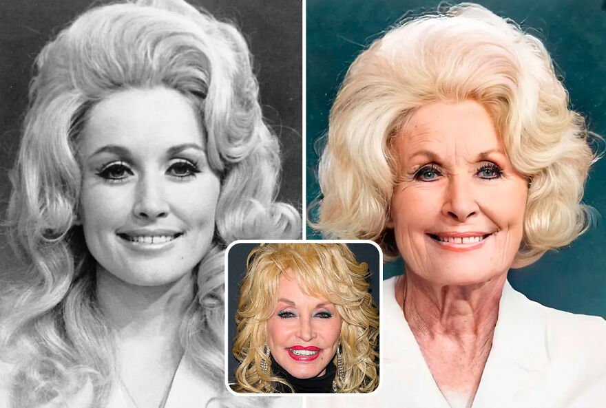 celebrities - without plastic surgery - dolly parton ypung