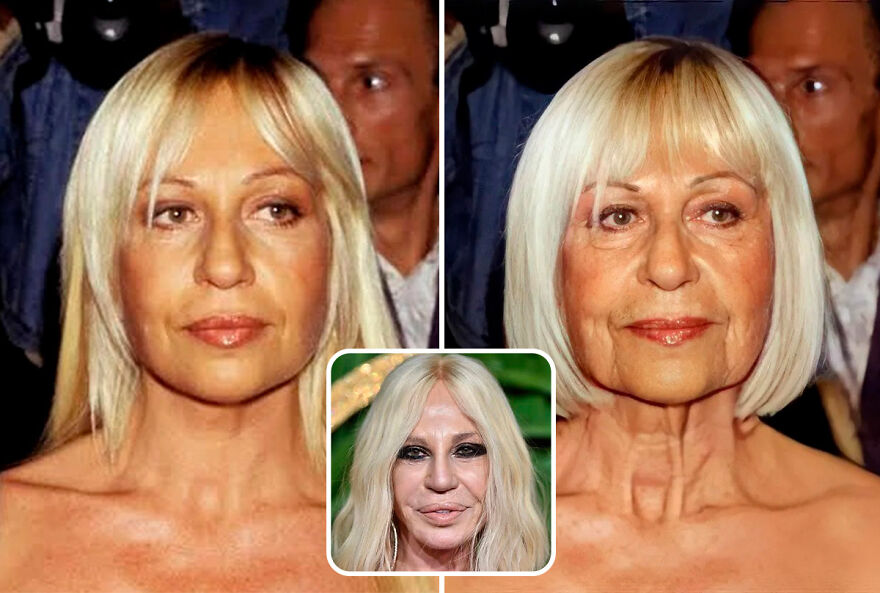 celebrities - without plastic surgery - donatella versace young