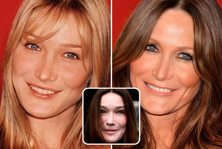 celebrities - without plastic surgery - carla bruni face lift