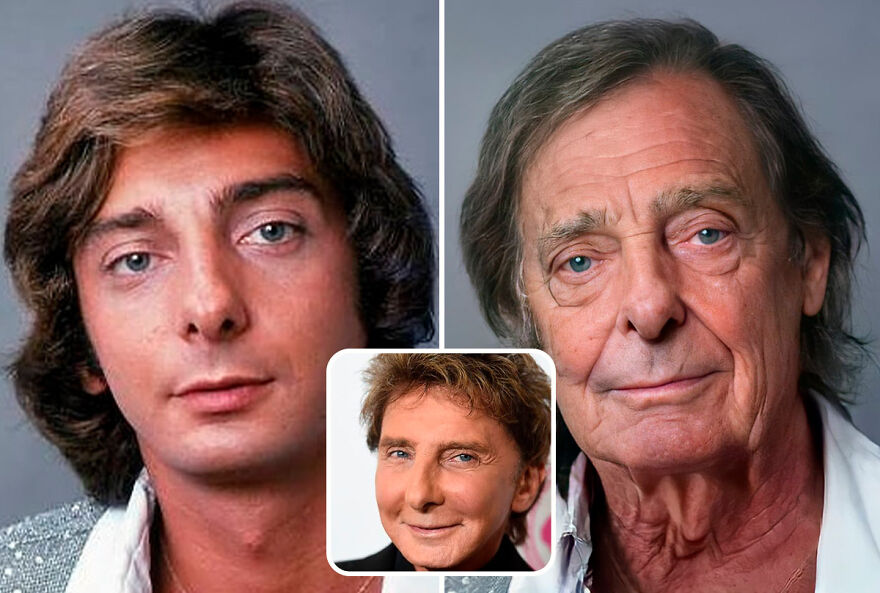 celebrities - without plastic surgery - barry mannilow teen