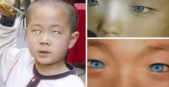 "This little boy has natural neon eyes."