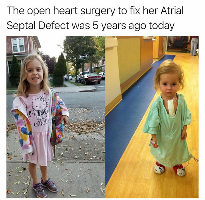 wholesome pics - atrial septal defect meme - The open heart surgery to fix her Atrial Septal Defect was 5 years ago today Circu