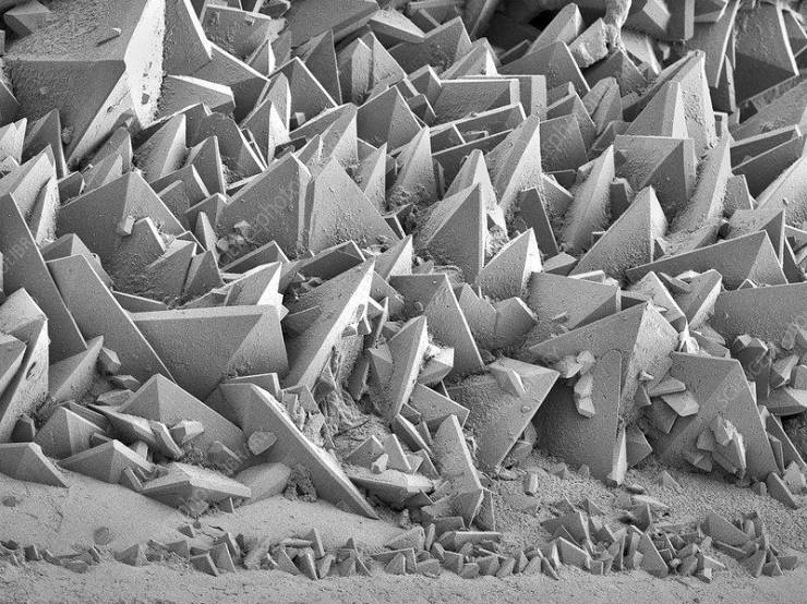 fascinating photos - kidney stone electron microscope - Bk