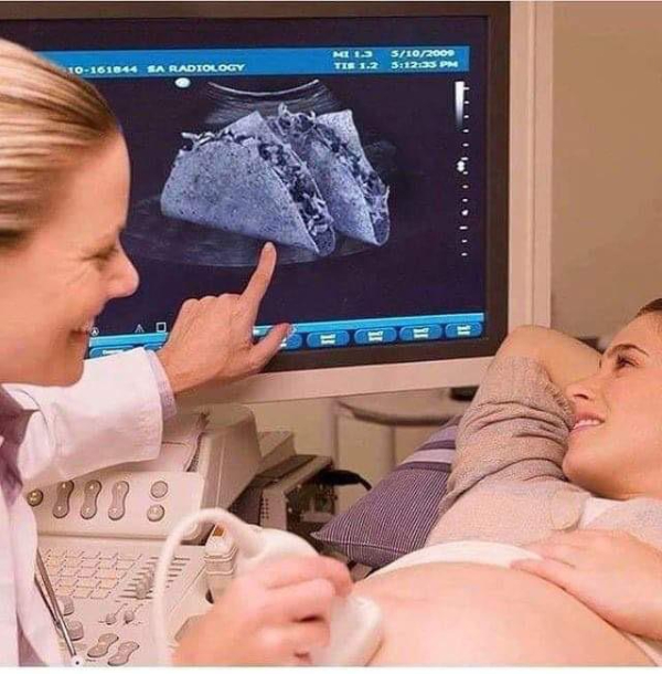 wtf pics - cursed images - level 2 ultrasound