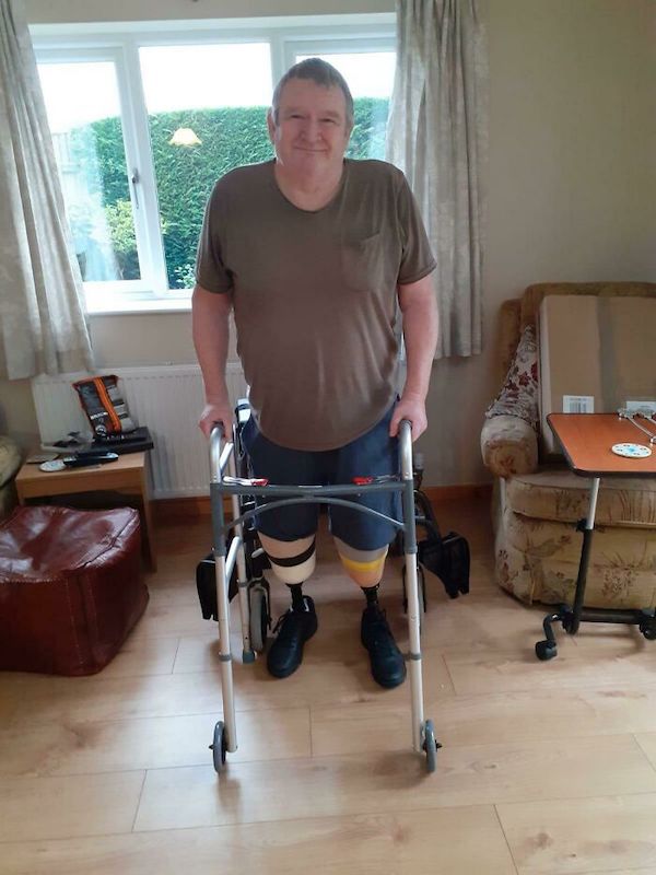 This is my dad. He and my mom live in the UK while I live in the USA. Since I saw them last, my dad lost both of his legs.

I was sent this just before Xmas, this is the first time my dad has stood up without having someone to help him since the amputation and I’m so proud of him.