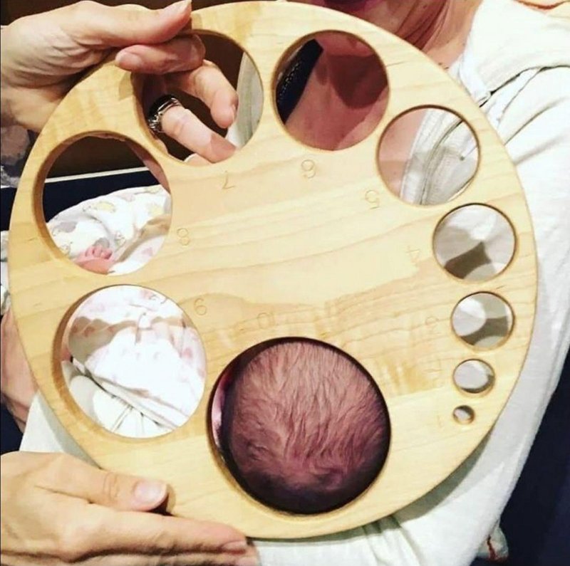 Cervical dilatation : this is what it looks like when they say the cervix is open at 1,2,3,4…10 cm