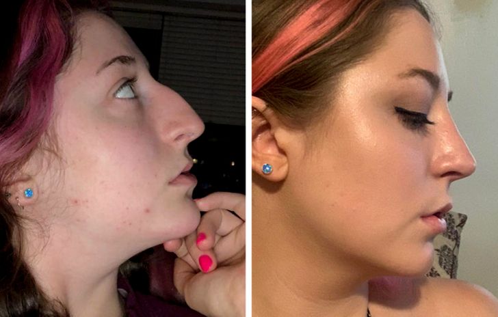 “9 months post glow up! It was the best decision ever.”