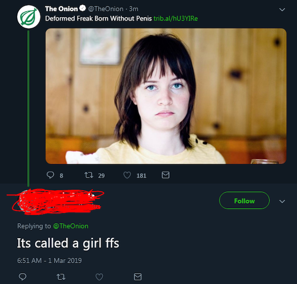 missed the joke  - onion deformed freak - The Onion 3m Deformed Freak Born Without Penis trib.alhU3YIRE 27 29 181 Its called a girl ffs t2