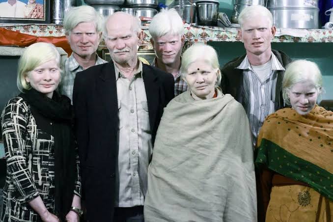 Albino family in India