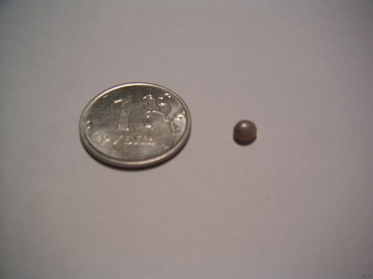 “I had mussels for dinner. This is what I found by almost breaking my tooth. It’s a real pearl!”