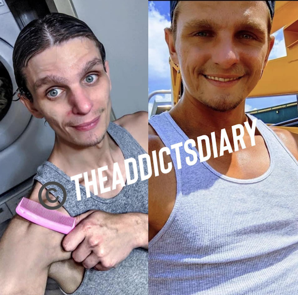 17 Inspiring Transformations Of Drug Addicts.